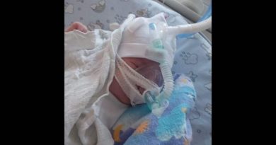 2-miesięczny Borys ze Swarzędza walczy