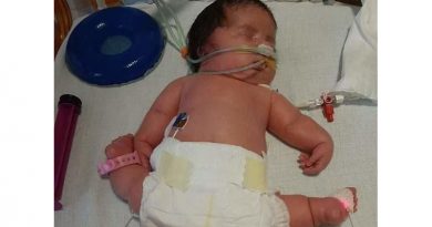 Helenka z Kobylnicy potrzebuje pomocy