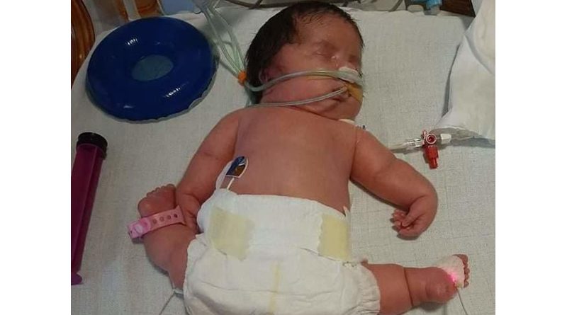 Helenka z Kobylnicy potrzebuje pomocy